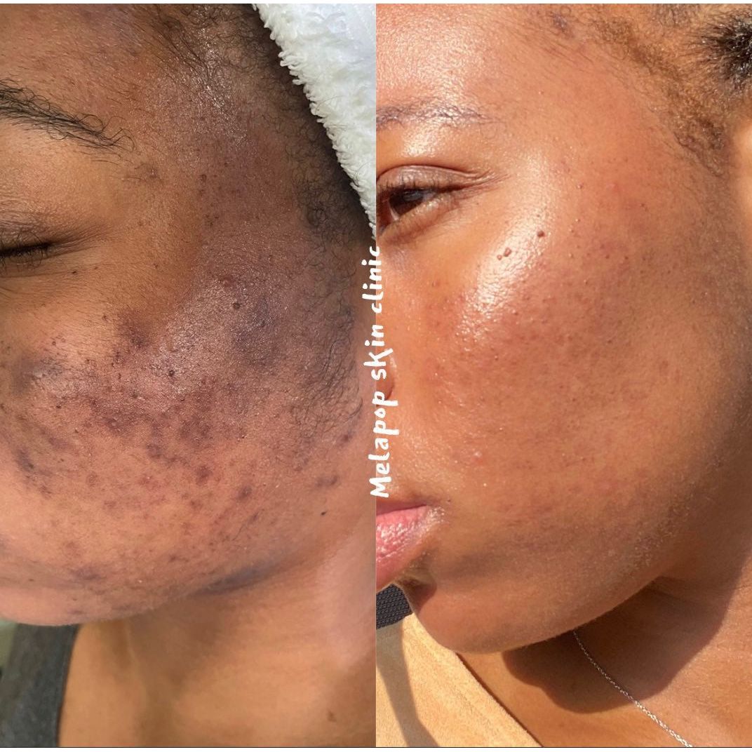 Donkey Milk Retinol image 1