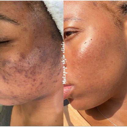 Donkey Milk Retinol image 1